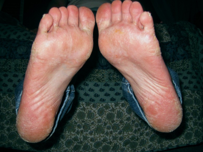 Things I Learned Going Without Shoes for One Day The Average Advocate